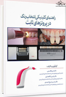 راهنمای کلینیکی انتخاب رنگ در پروتزهای ثابت